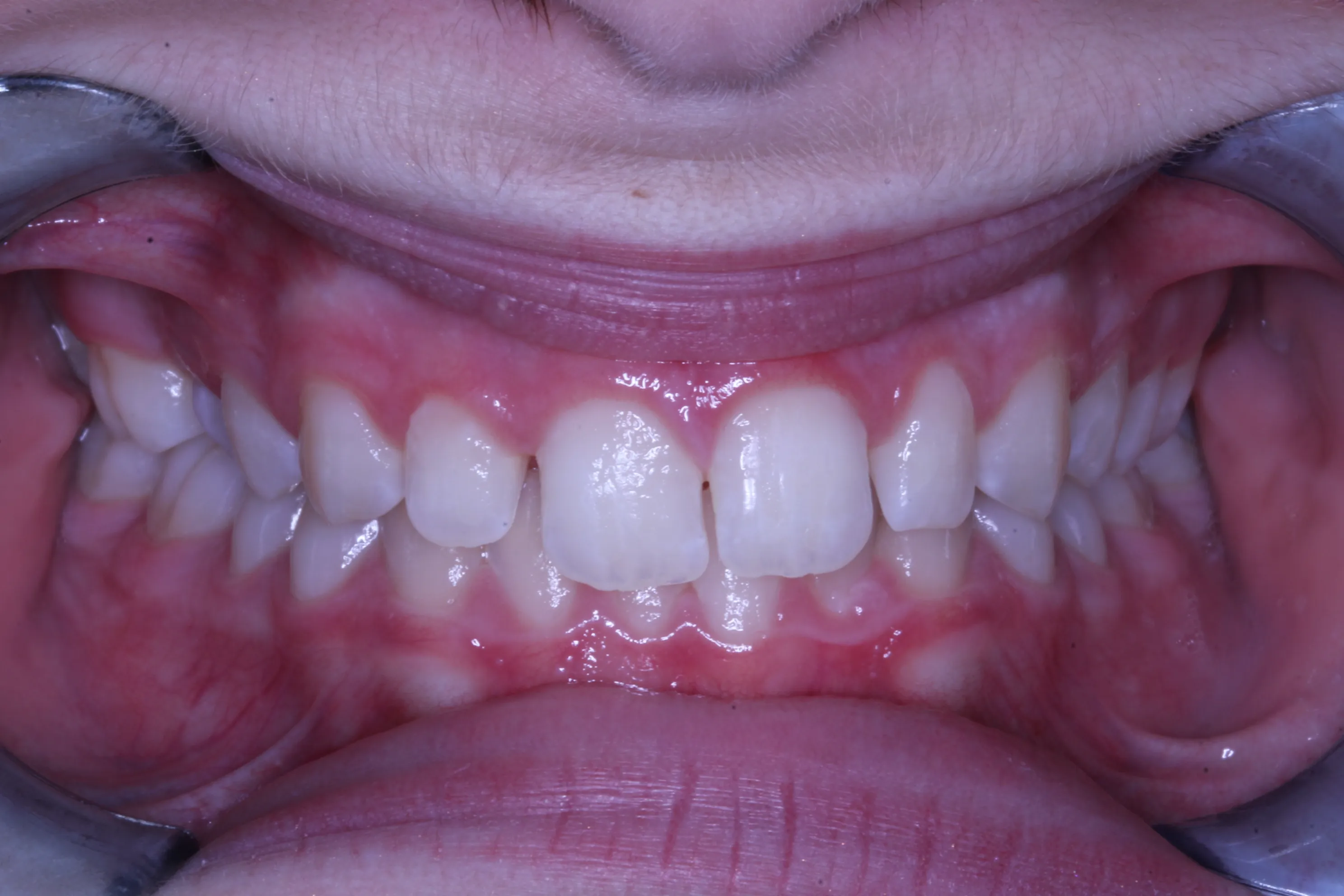 smile-gallery gallery